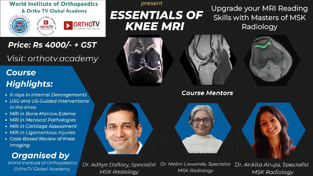 Essentials of Knee MRI