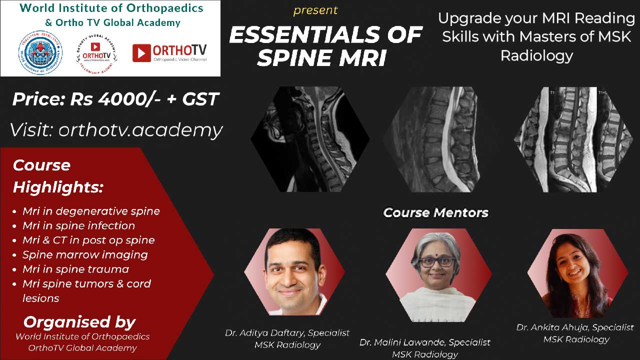 Essentials of Spine MRI